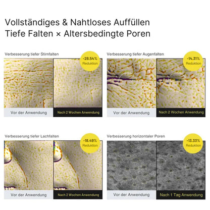 Vita-A Lift Effect – Das Duo für straffere Haut