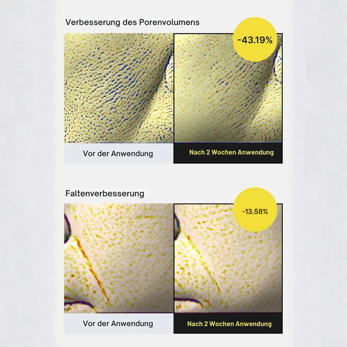 Vita-A Lift Effect – Das Duo für straffere Haut