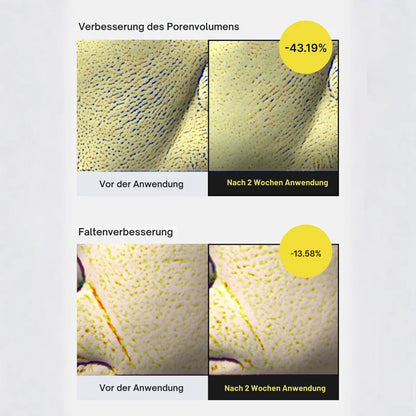 Vita-A Lift Effect – Das Duo für straffere Haut